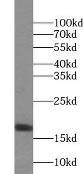 UBE2I Mouse Monoclonal Antibody