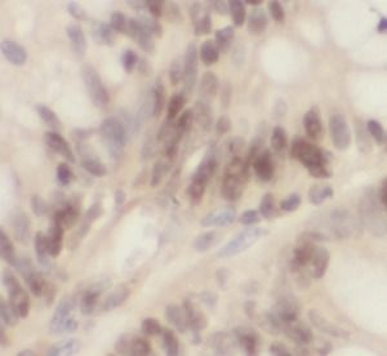 UBD Antibody