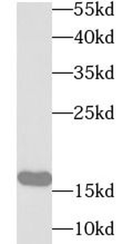 UBE2B Antibody