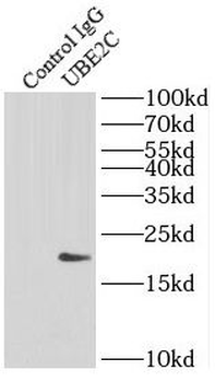 UBE2C Antibody