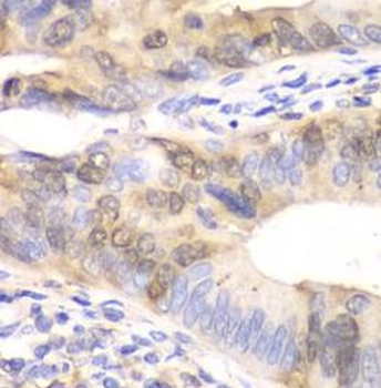 UBE2C Antibody