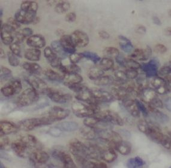 UBE2C Antibody