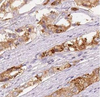 UBE2D3 Antibody