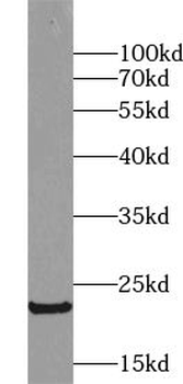 UBE2E2 Antibody
