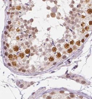 UBE2E2 Antibody