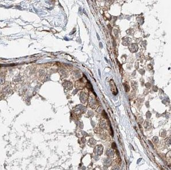 UBE2F Antibody