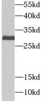 UBE2J2 Antibody