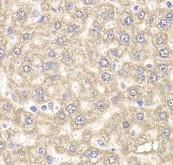 UBE2J2 antibody