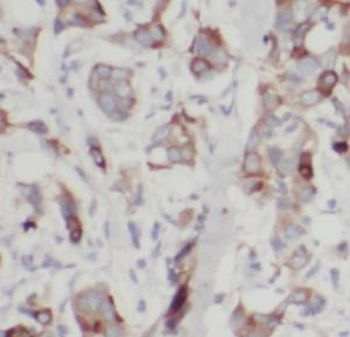 UBE2S Antibody