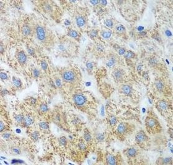 UBE2U Antibody