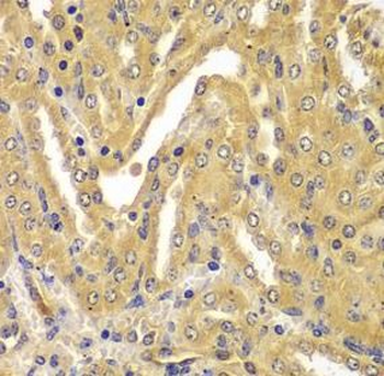 UBE2Z Antibody