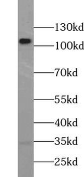 UBE3A Antibody