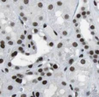 UBE3A Antibody