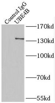 UBE4B Antibody