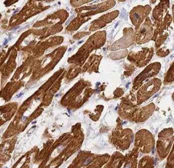 UBE4B Antibody