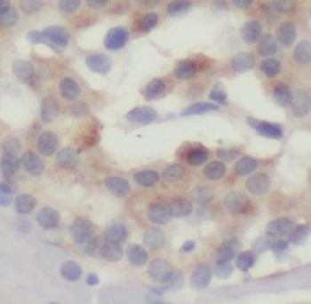 UBQLN1 Antibody
