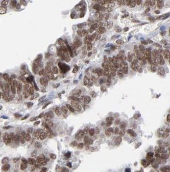 UBLCP1 Antibody