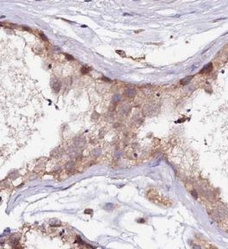 UBN2 Rabbit Polyclonal Antibody