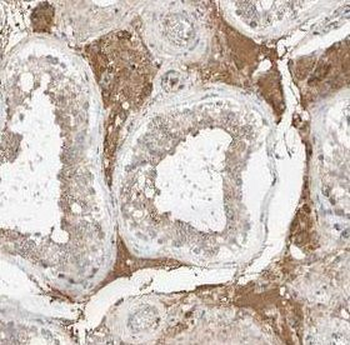 UBQLN2 Antibody