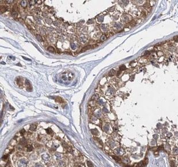 UBQLNL Antibody