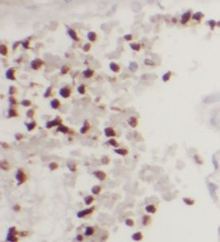 UCHL5 Antibody