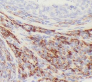 HAUS7 Antibody