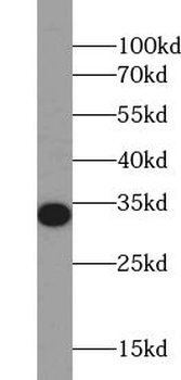 UCK1 Rabbit Polyclonal Antibody