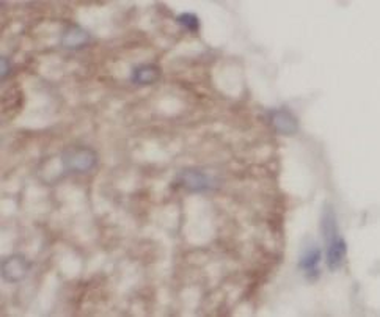 UCP1 Antibody