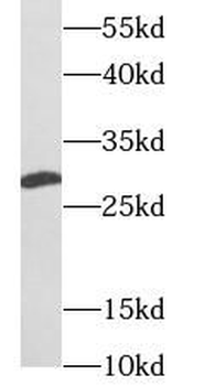 UCP2 Antibody