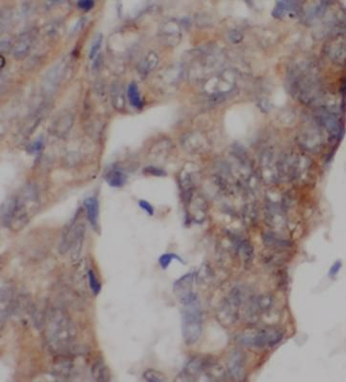 UCP2 Antibody