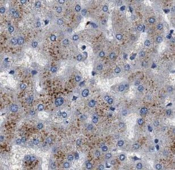 UFC1 Antibody