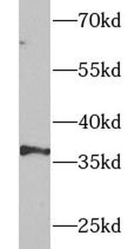 UFD1 Antibody