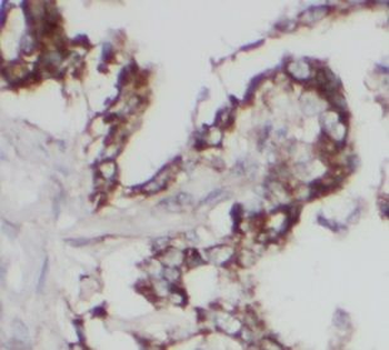 UGCG Antibody