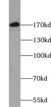 UGGT1 Rabbit Polyclonal Antibody