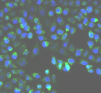 UGDH Antibody