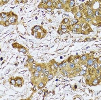 UGDH Antibody