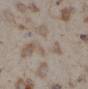 UGT8 Antibody
