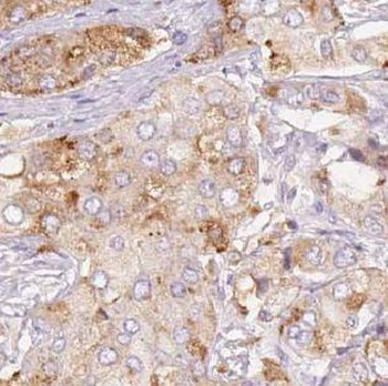 UHMK1 Antibody