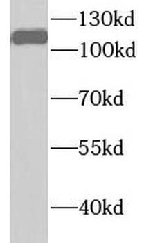 UHRF1 Antibody