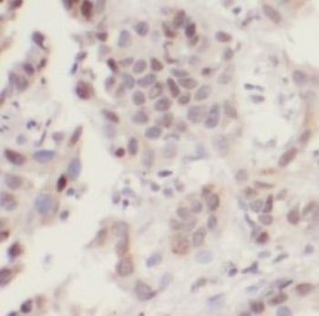 UHRF1 Antibody