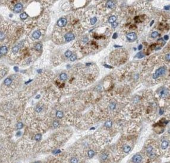 ULBP1 Antibody