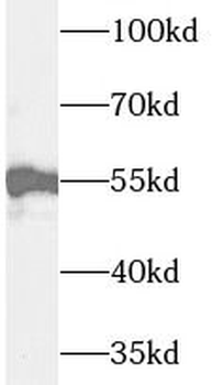 UMPS Antibody