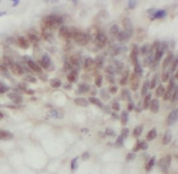 UMPS Antibody
