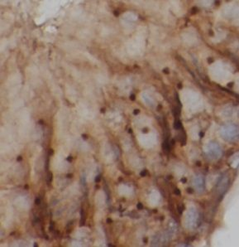 UNC13D Antibody