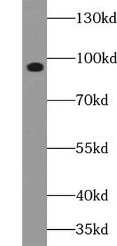 UNC45B Rabbit Polyclonal Antibody