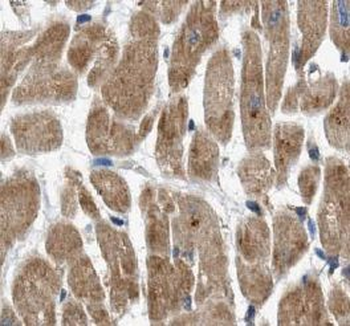 UPB1 Antibody
