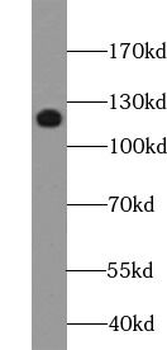 UPF1 Antibody