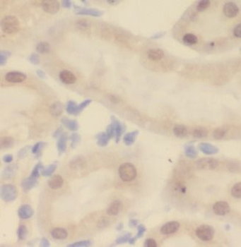 UPF1 Antibody