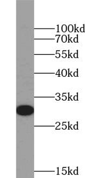 UPK2 Rabbit Polyclonal Antibody