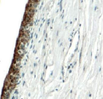 UPK2 Rabbit Polyclonal Antibody